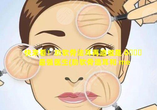 快来看！肋软骨法耳再造谁是 🍁 最强医生(肋软骨造耳和 medpor哪 🕊 个效果好)